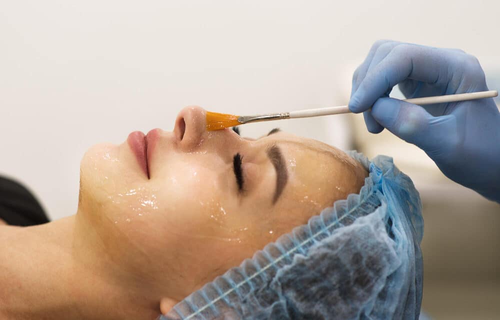 Peeling PRX-T33: cos’è, come funziona e per chi è indicato